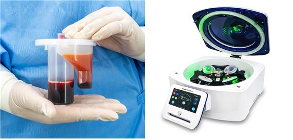 줄기세포로 허가받은 스마트엠셀+골수키트BMSC