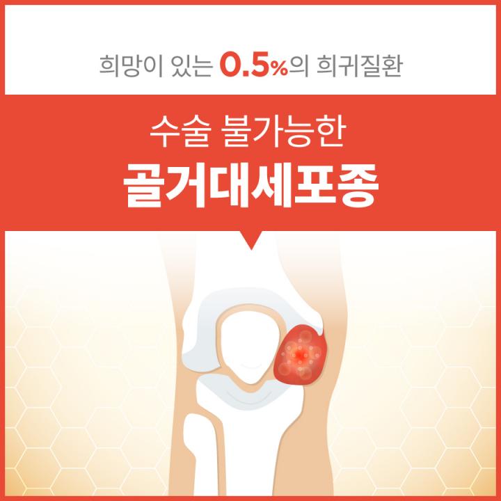 의학신문_카드뉴스_골거대세포종 (1)