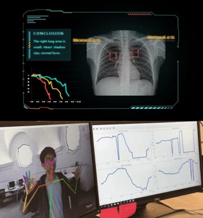 (상단 부터) 즈잉의료의 흉부영상건강관리시스템과 텐센트의 파킨슨병 AI 진단 모델