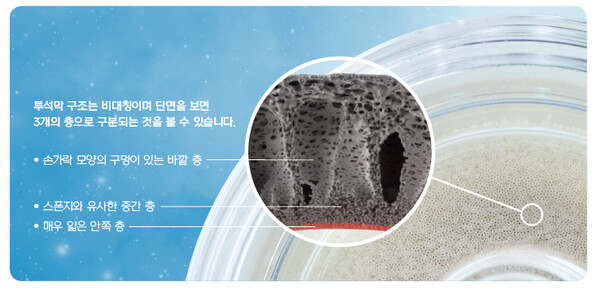 투석막 구조 단층 이미지<br>