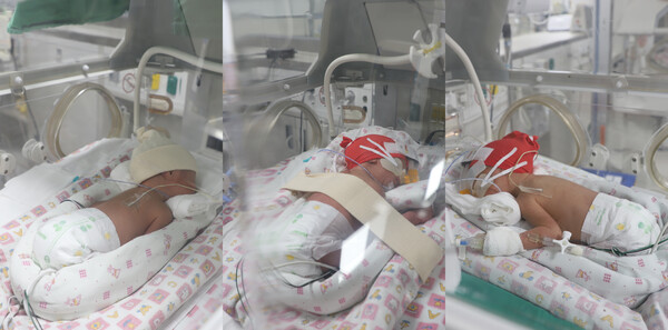 게명대학교 동산병원에서 태어난 세쌍둥이(왼쪽부터 첫째, 둘째, 셋째)<br>