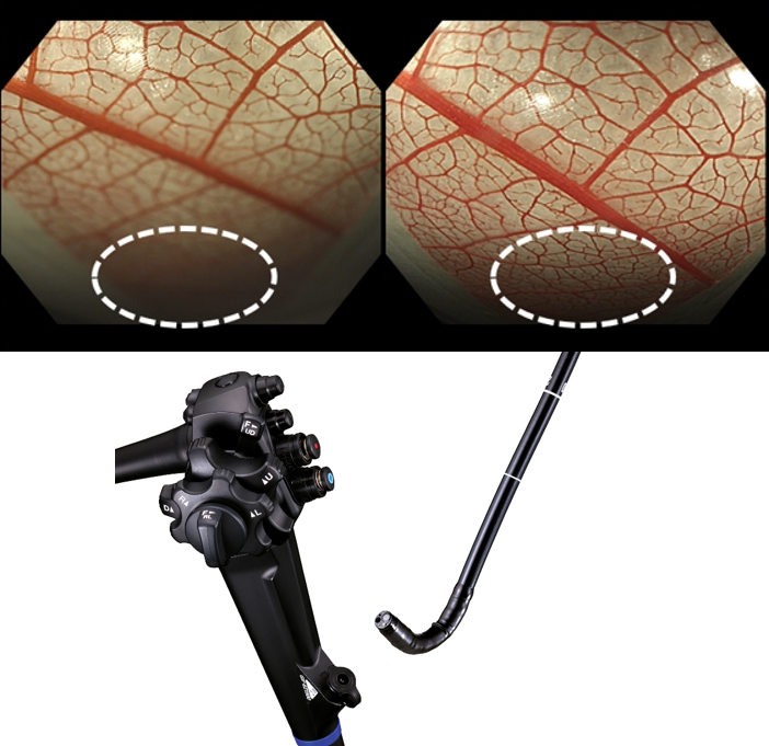 (좌측상단에서 시계방향으로)기존 스코프와 EDOF 기능 탑재 스코프로 장기 모형을 관찰한 비디오 이미지 비교, EDOF 기능이 탑재된 전용 스코프 제품