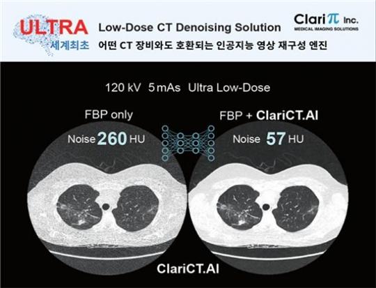 AI 기반의 CT 노이즈 제거 솔루션 ‘ClariCT.AI’