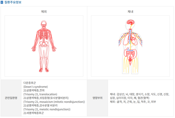 다운증후군 질환발생 영향부위(제공: 질병청 헬프라인)