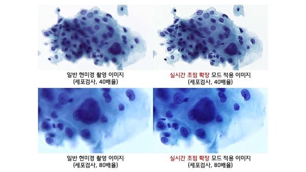 세포 슬라이드 영상에서 선명한 영역만을 선별해 합성하는 ‘실시간 초점 확장’ 기술을 적용한 모습