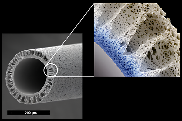 테라노바의 비대칭 3중 구조