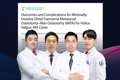 SNU서울병원 족부전담팀(서상교 대표원장, 이동오 원장, 강태병 원장, 이정환 원장)이 SCI급 국제학술지에 최소침습 무지외반증 수술(MITA) 논문을 발표했다.