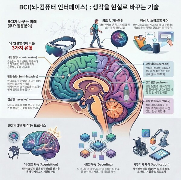 생각으로 움직이는 세상 현실화, 중국 침습형 BCI 상용화 - 뉴스 썸네일 이미지