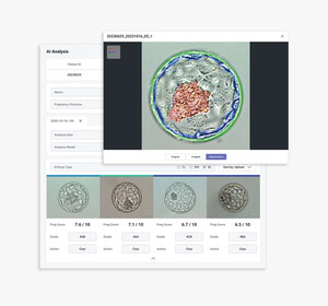 카이헬스, 인도 최대 난임 클리닉에 AI 기반 배아분석 솔루션 공급 - 뉴스 썸네일 이미지