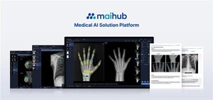 마이허브, 뷰노 골연령 판독AI 인수…의료 AI 플랫폼 경쟁력 강화