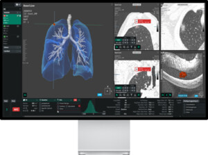 코어라인소프트, 오세아니아 시장 구조적 성장기 진입 - 뉴스 썸네일 이미지